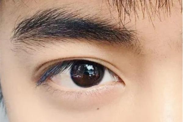 眉心长白毛的命理解析:背后隐藏的生活密码与性格特征 眉心长白毛的命理解析:背后隐藏的生活密码与性格特征