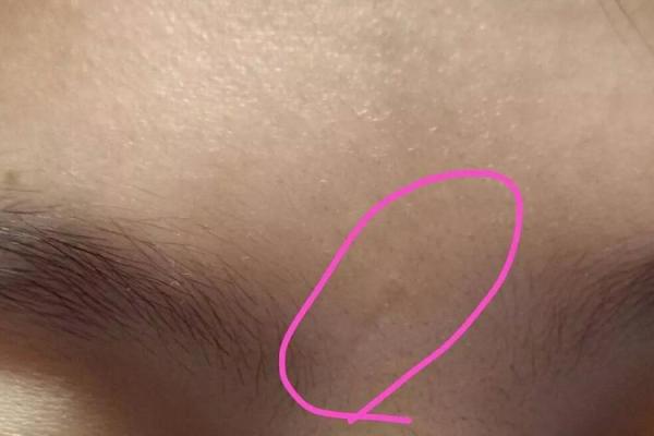 男人印堂发红的命运解析,揭示生活中的隐秘真相! 男人印堂发红的命运解析,揭示生活中的隐秘真相!