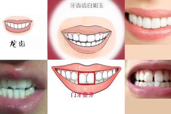 探秘面相:门牙的象征与命运解析 探秘面相:门牙的象征与命运解析