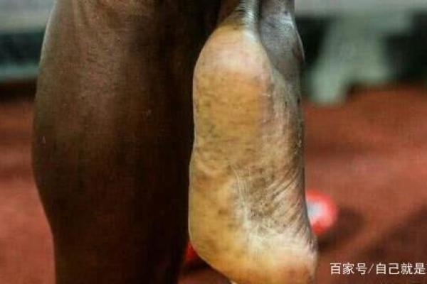 男人脚大脚长,潜藏着哪些人生秘密? 男人脚大脚长,潜藏着哪些人生秘密?