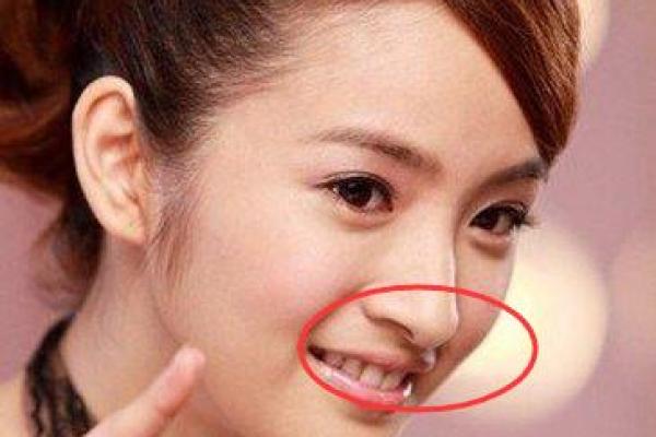 女生鼻子挺与命运的另类解读:美丽与自信的象征 女生鼻子挺与命运的另类解读:美丽与自信的象征