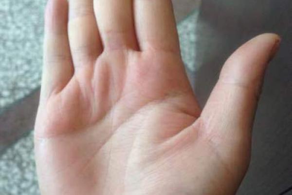 从两个指头的长度看人生的命运与性格探秘 从两个指头的长度看人生的命运与性格探秘
