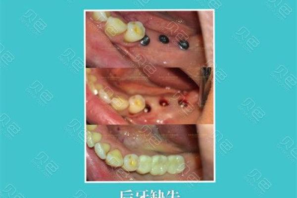 门牙缝隙大揭秘:你是否知道它背后的命理故事? 门牙缝隙大揭秘:你是否知道它背后的命理故事?