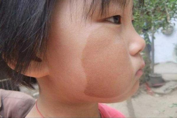 胎记与命运:揭秘女人胎记背后的真实寓意与人生轨迹 胎记与命运:揭秘女人胎记背后的真实寓意与人生轨迹