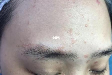脸上长疣的女人，命运之路如何逆袭？