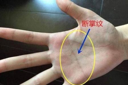 男人双手断掌，命运的指引与生活的启示