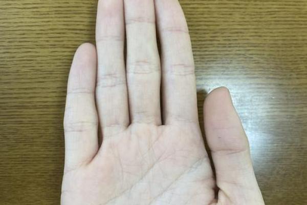 男生没指甲的秘密:揭示隐藏在指尖下的命运真相 男生没指甲的秘密:揭示隐藏在指尖下的命运真相