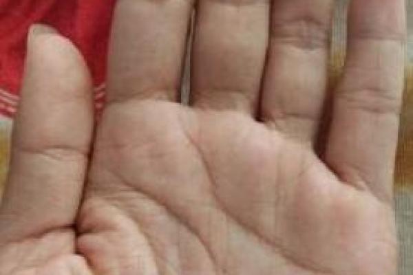 男人手指头没肉的命运揭秘,细节与性格解读! 男人手指头没肉的命运揭秘,细节与性格解读!