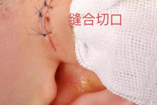 男人有耳仓是什么命?解密耳仓的命理与影响 男人有耳仓是什么命?解密耳仓的命理与影响