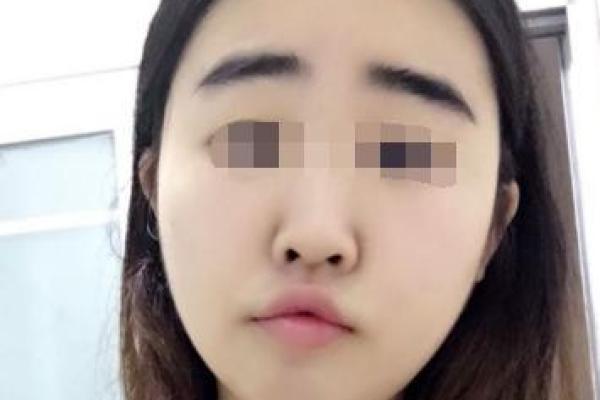 探秘印堂凹陷:面相学中的命运密码与深藏的智慧 探秘印堂凹陷:面相学中的命运密码与深藏的智慧