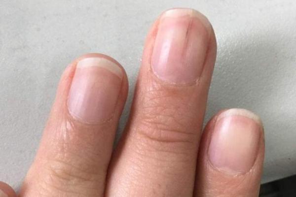 男人手上的指甲与命运的关系解析:揭开隐藏的秘密 男人手上的指甲与命运的关系解析:揭开隐藏的秘密