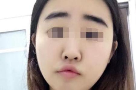 探秘印堂凹陷：面相学中的命运密码与深藏的智慧