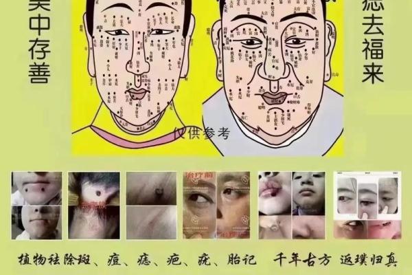 眉头两颗痣的命运解析:揭示你的人生轨迹与性格特征 眉头两颗痣的命运解析:揭示你的人生轨迹与性格特征
