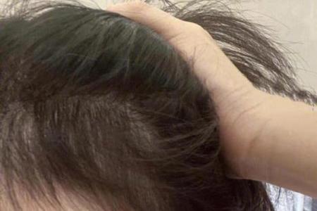 女人头发秃背后的秘密：命运与自信的双重考验