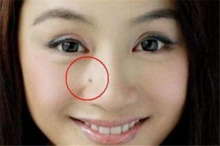 探秘：男人右背腰长痣为何被认为命好？